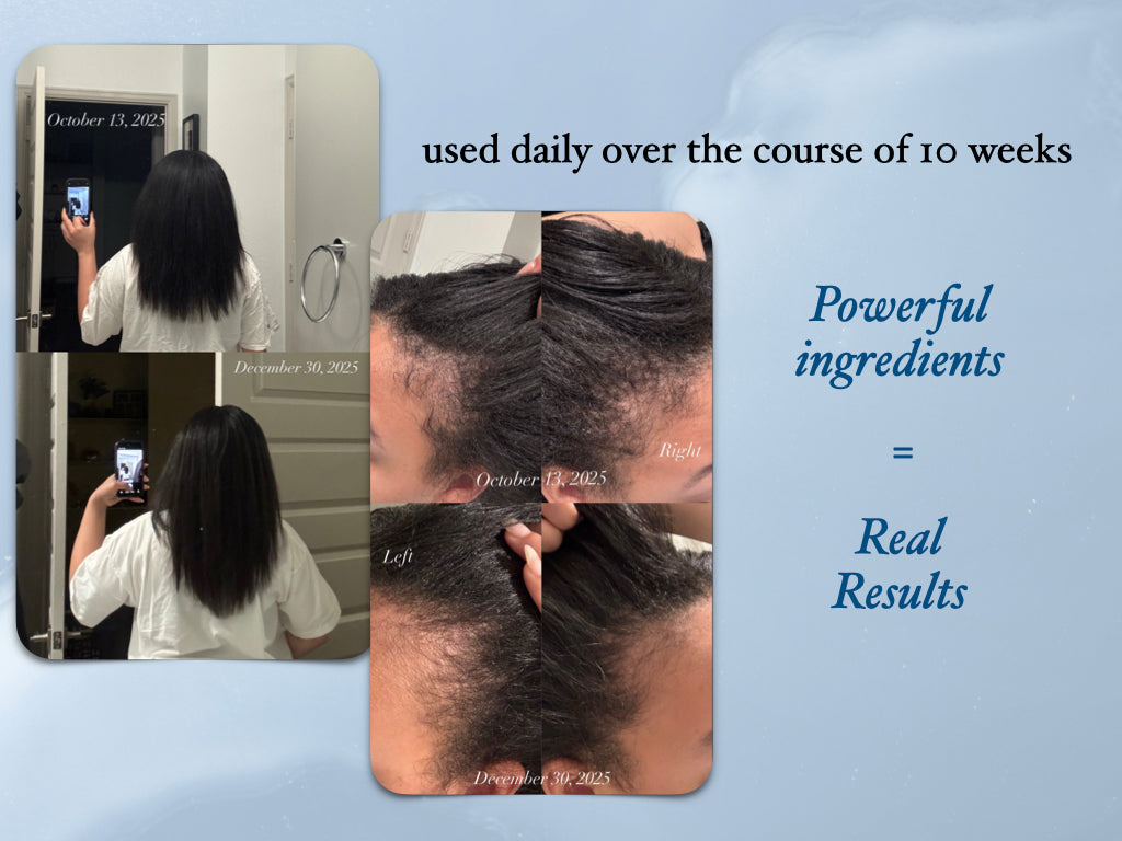 Recover Real Good Scalp Serum